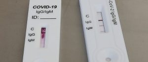 Test sierologici COVID-19